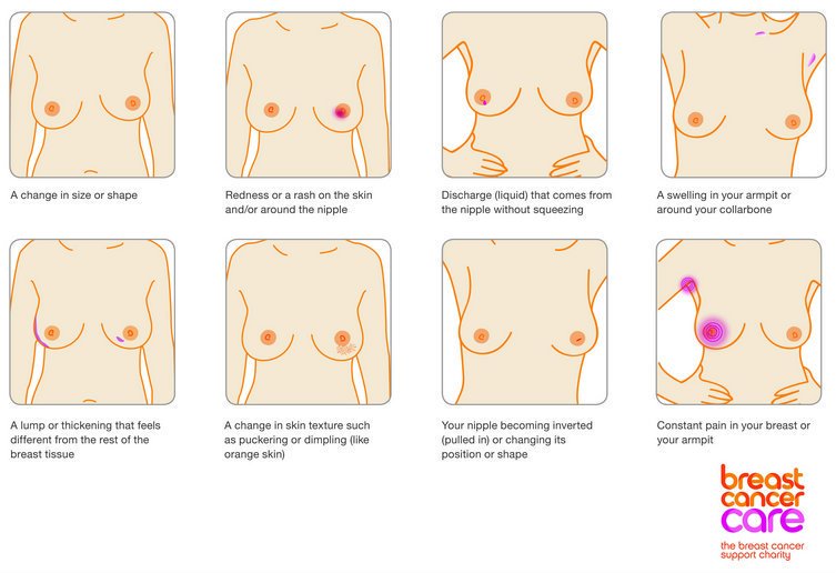 healthybrum's tweet photo. Are you #breastcancer aware? Please RT this potentially life-saving info and get that #FridayFeeling https://t.co/7Q2jWoKnwp  #healthybrum https://t.co/cIfRMnPfYH