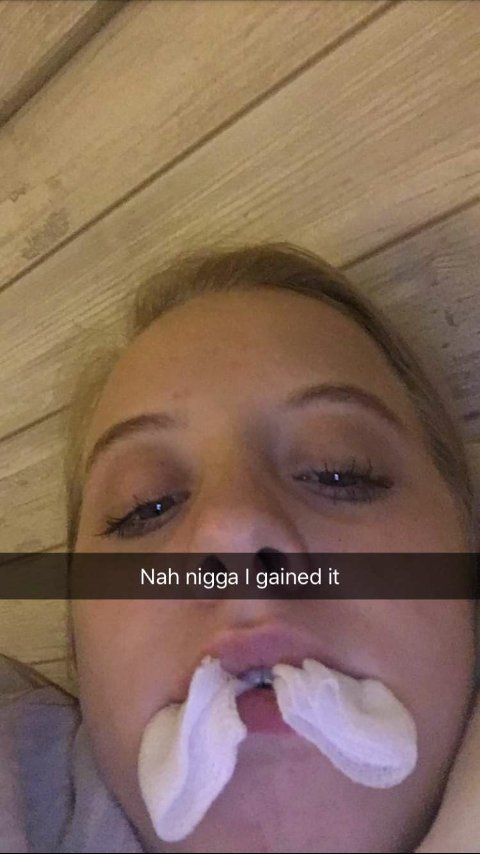 MakaylaTippins's tweet photo. "did you lose all your wisdom?" #wisdomteethgone https://t.co/SK62H19Ac3