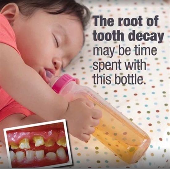YellFamDental's tweet image. Did you know you should never send your child to bed with anything but water? Even milk can cause tooth decay! #yfdental