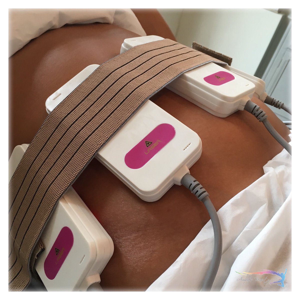 AmbysBeauty's tweet photo. Weight loss, without exercise, diet, or down time and definitely no surgery! 🙌🏼 #laserlipo #winning ➡️ you and a friend just £26 ‼️ https://t.co/QP7WY9iJkK