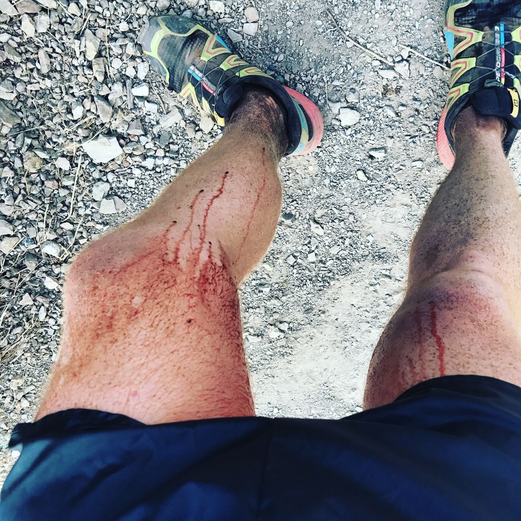 JeffreyBinney's tweet photo. Hey kids...don't wear new running shorts on your long run...k? #chaffed #chafing #ultrarunnerproblems #ultrarunner #ultrarunning  #manperiod https://t.co/4jpjYeNieN