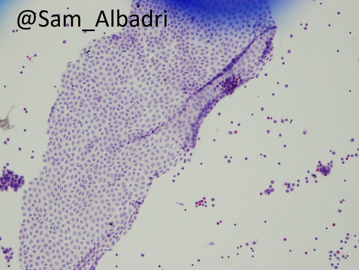 Sam Albadri, M.D., M.Sc. tweet media