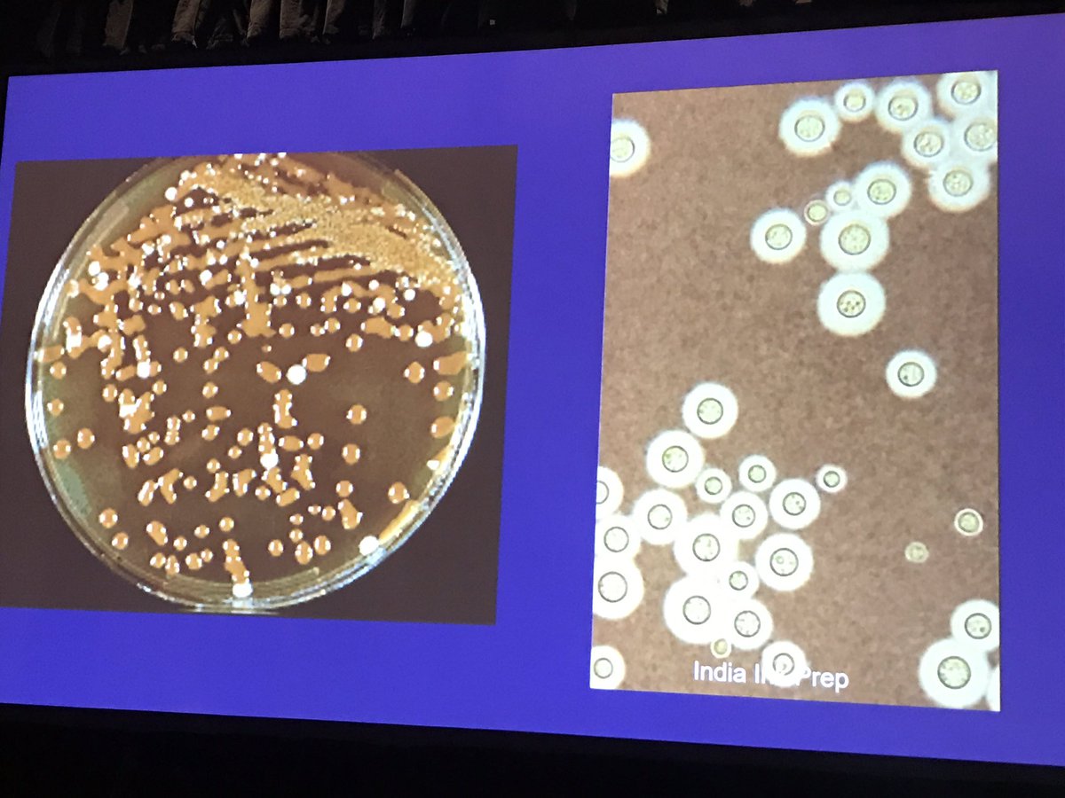 Cutaneous cryptococcal infection | grown on bird seed agar #Dermpath #dermatology #microbiology #boardfodder #PracticalSymposium17
