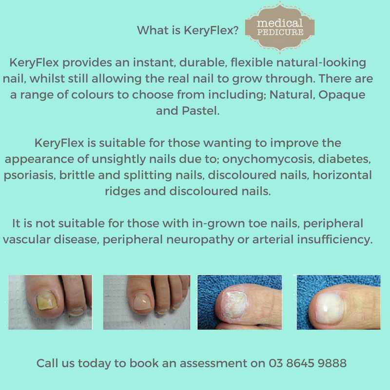 MedicalPedi's tweet photo. #keryflextreatment #nails #healthyfeet #medicalpedicure #pedicure https://t.co/90b1PD2cYT