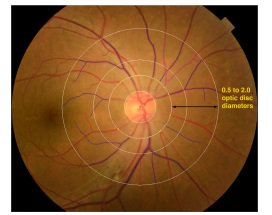 Diabetologia tweet media