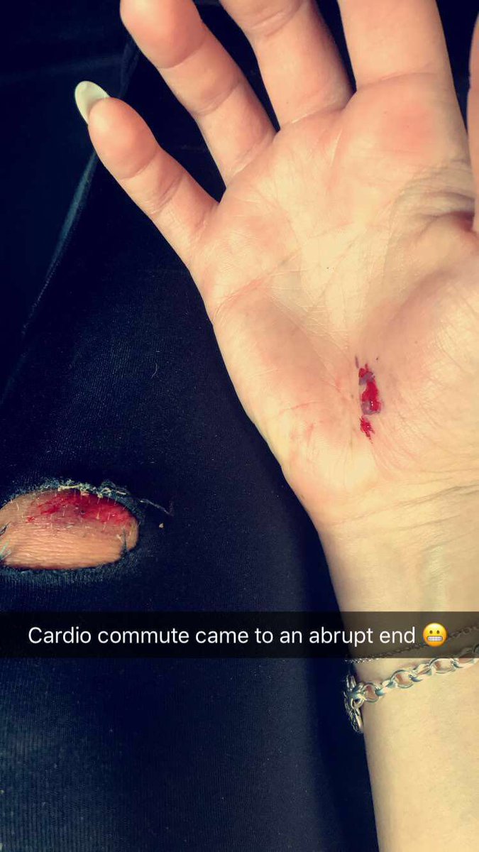 Took a tumble this morning on my #cardiocommute my @NikeUK leggings didn't make it though 😢t-minus 9 weeks until 26.2miles!