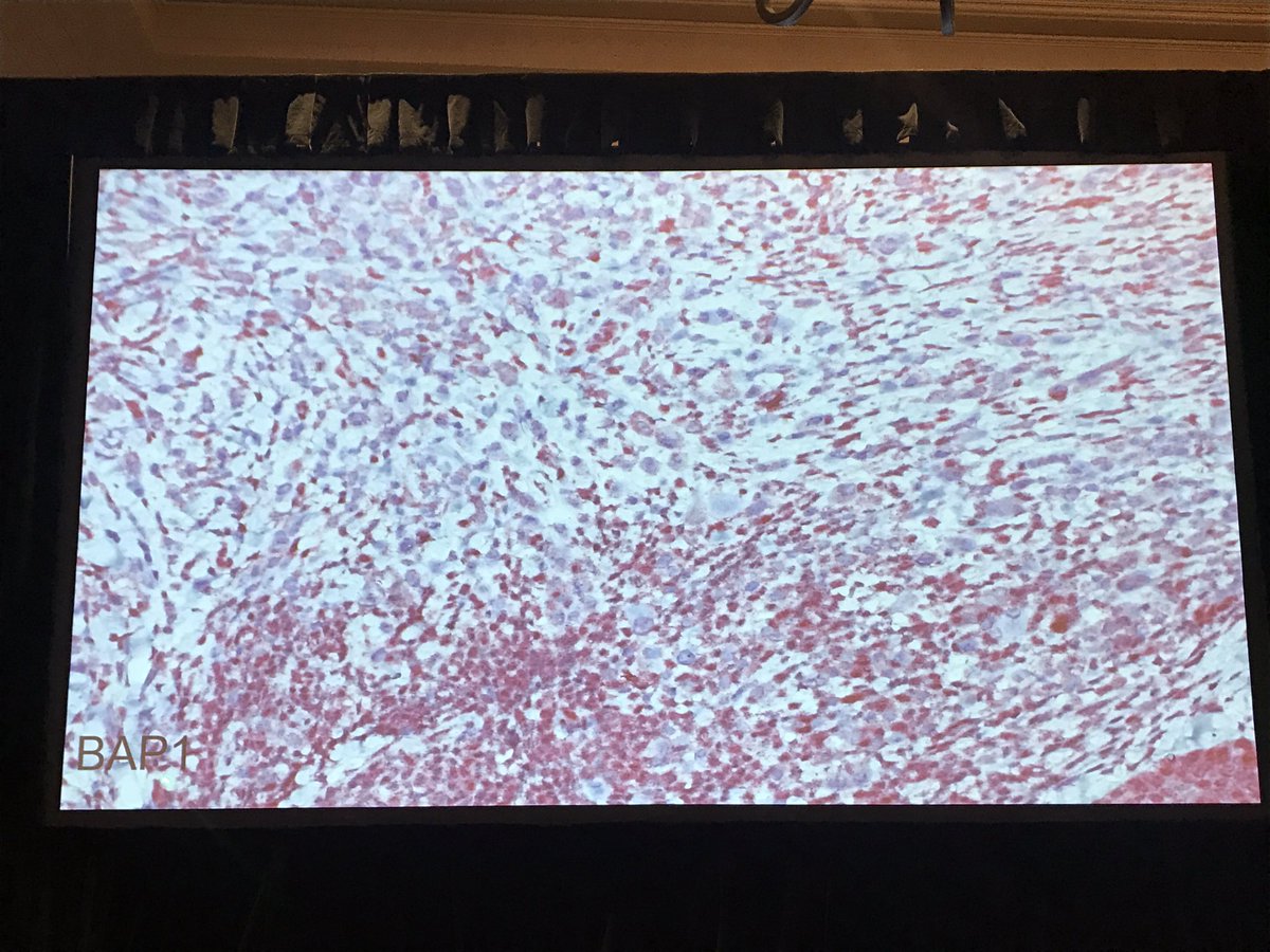 AnnieMorrisonMD's tweet photo. Great example of BAPoma from Dr Whitney High at #PracticalSymposium17 #dermatology #dermpath #pathology https://t.co/I1xMXmXRVQ