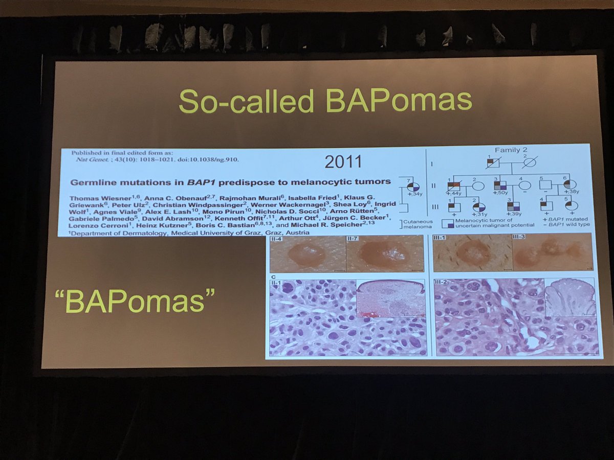 Great example of BAPoma from Dr Whitney High at #PracticalSymposium17 #dermatology #dermpath #pathology