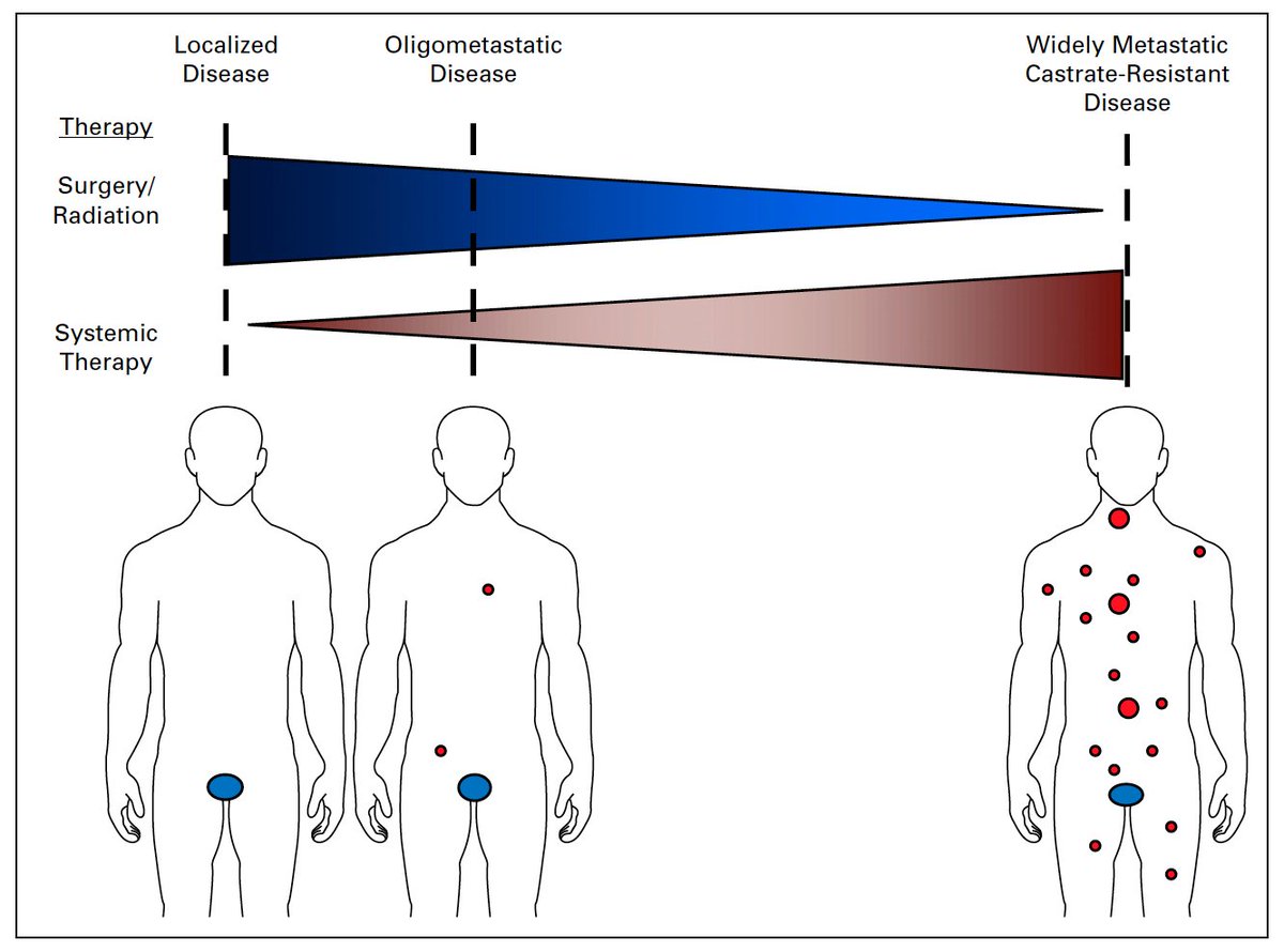DrewMoghanaki's tweet photo. The doctrine of abandoning local tx once there is metastasis is old, and being actively re-investigated. #raonc https://t.co/RSZztcmnOr https://t.co/xuMIIShTNZ