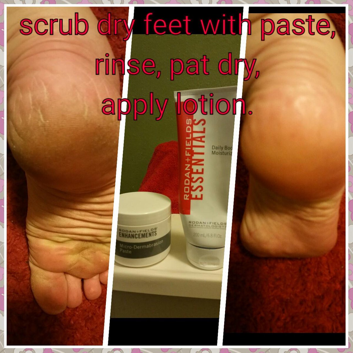ashley_sharp91's tweet image. Crusty feet no more!! Ask me how! #microdermabrasion #smoothasababysbutt #rodanandfields