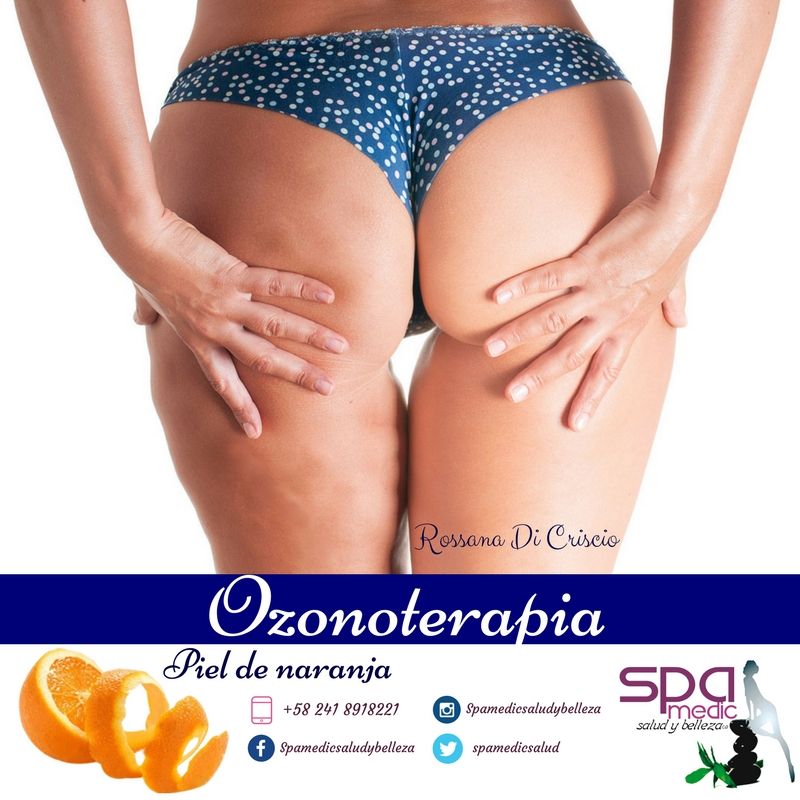 spamedicsalud's tweet photo. OZONOTERAPIA: #gluteos#belleza#celulitis#salud #estrias #soycirujano #regalo #mujer #spamedicsalud #rossanadicriscio https://t.co/D356jMpIqr https://t.co/3ZmYOZCFMG