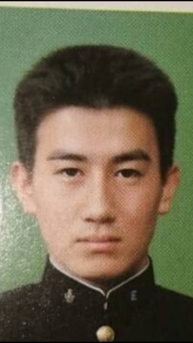 だーりんず 松本りんす 植毛日記 10 ハゲる前 ハゲる カツラ着用 取る そして 次は植毛した毛が生えてくる 私の頭は多忙です 何でも聞いて