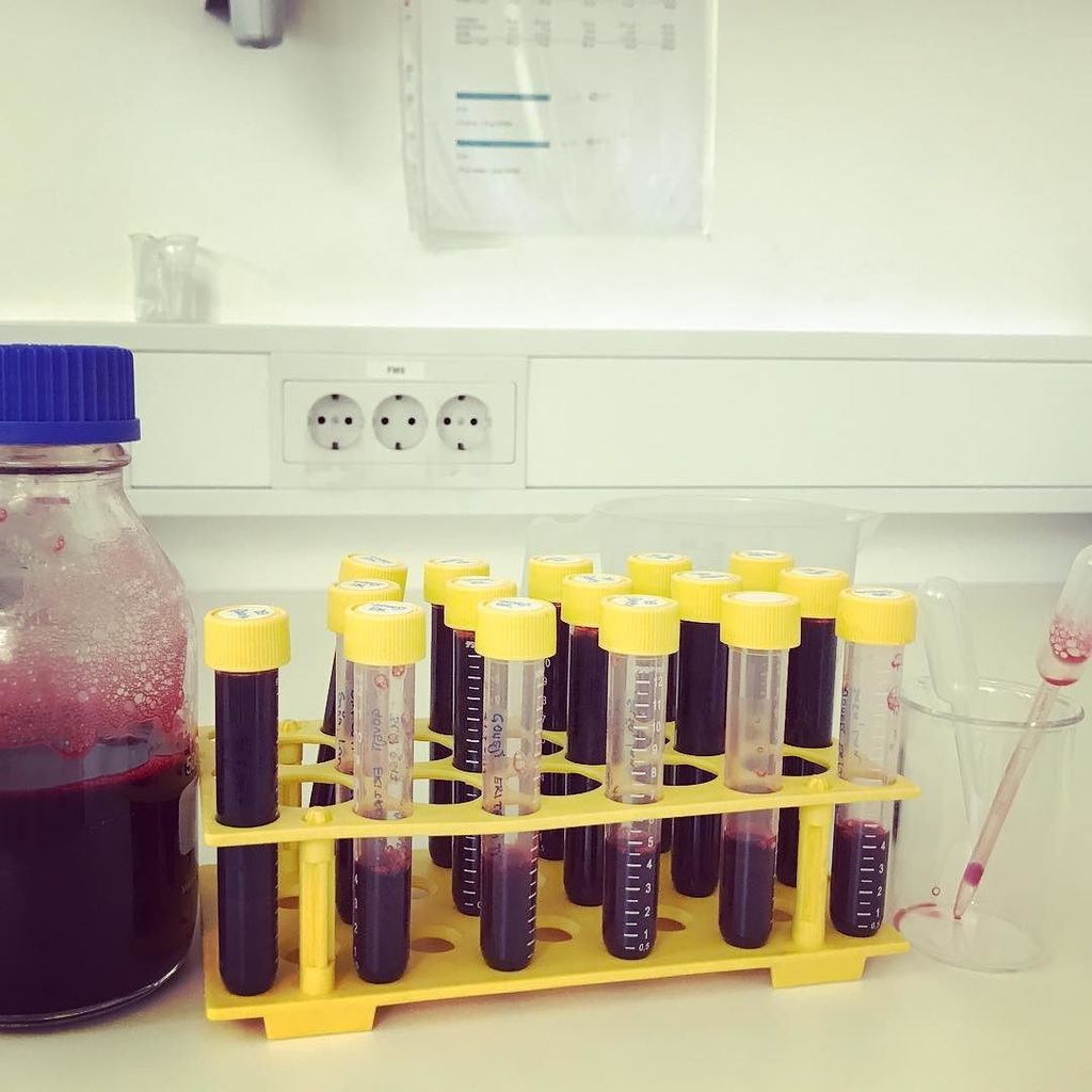 DrSasaAden's tweet photo. Bloody day at work @D11_NIC #everythingfor : #science #poreformingtoxins #blood #reaearch https://t.co/zTMARJrL7V