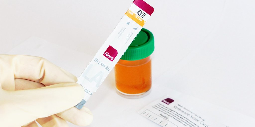 Cochrane Review: Lateral Flow Urine Lipoarabinomannan Test to Detect TB in People with HIV