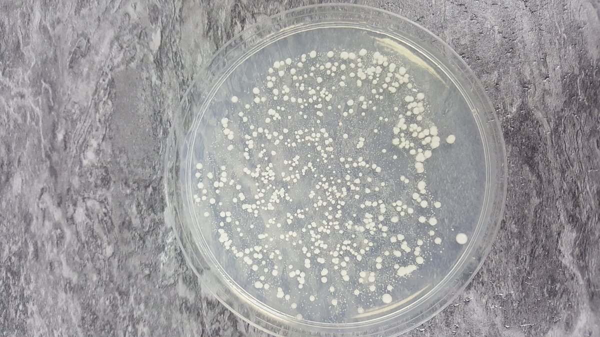 MPSMicro's tweet image. Never good to have spots.....