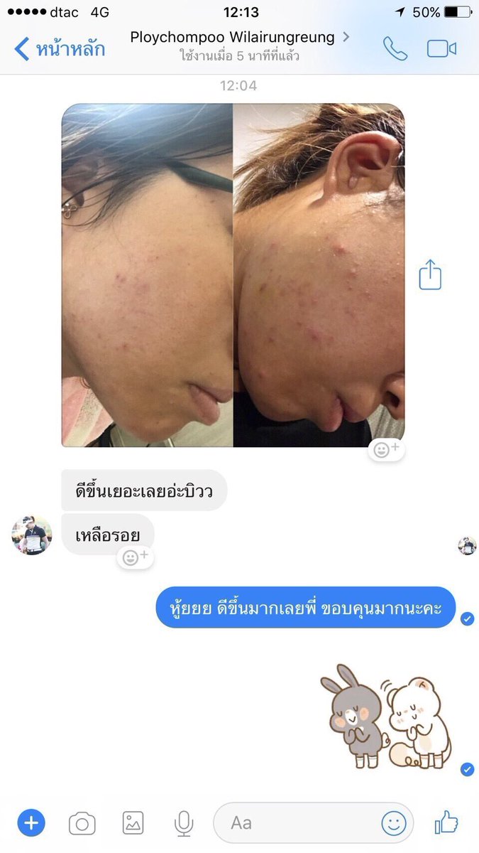 SoulZenShopBKK's tweet photo. Review from customer :) #SoulZen #SoulZenShop #โฟมล้างหน้าออร์แกนิคที่ดีที่สุด #โฟมล้างหน้ารางจืด #คลีนซิ่งนางฟ้า #ลดสิวผด #ลดสิวอุดตัน https://t.co/YKw0Suo3j1