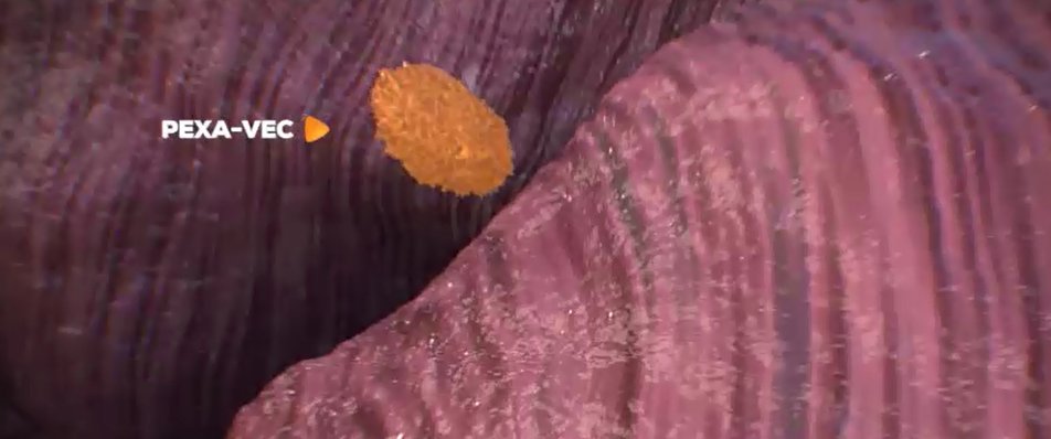 1st patient treated in clinical trial combining oncolytic virus Pexa-Vec with nivolumab in liver cancer ow.ly/fPJZ30e2TEA