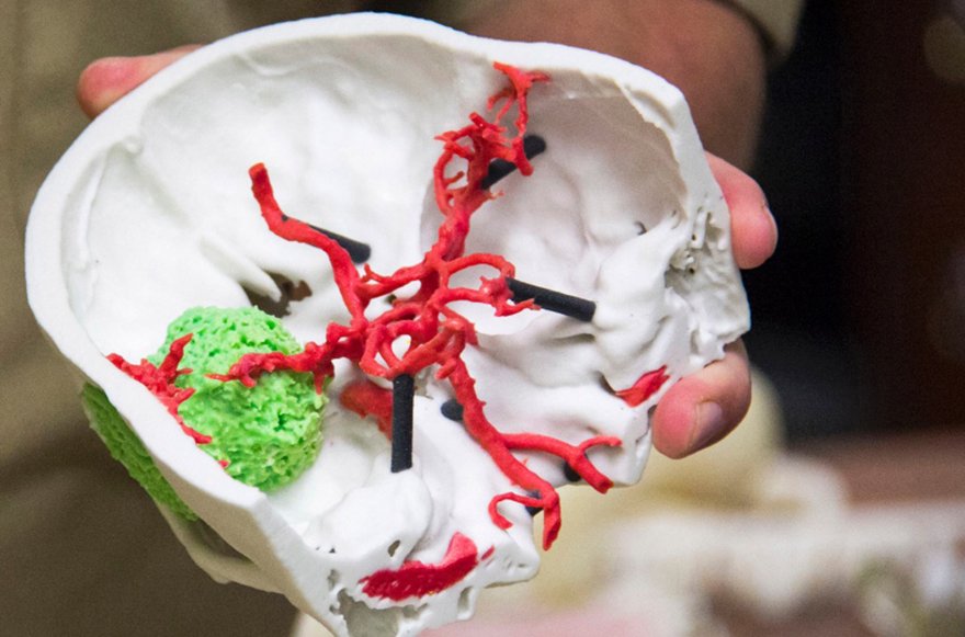 AdditiveCare's tweet photo. Ask your doctor to 3D print your MRI or CT scan. 3D Prints improve patient outcomes & overall satisfaction. #Med3D https://t.co/EaOoDlyonn https://t.co/JjqUNinhLt