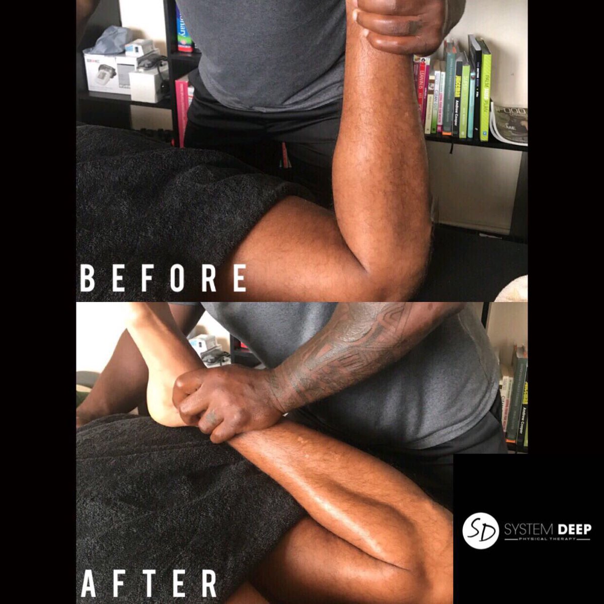 system_deep's tweet photo. 17 weeks post OP ACL R.O.M increase, massage,strength exercises,manipulation. #ACLRehab #investinyou #injuryrehab #systemdeepclinic #massage https://t.co/cH8fx6Ltcx