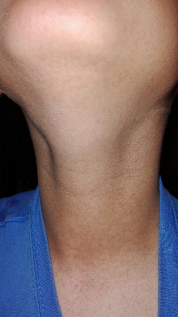 bomberosolo's tweet photo. Si presentas los siguientes síntomas 
Dolores musculares y articulares
Malestar y dolor de cabezaConjuntivitis
y erupciones en la piel https://t.co/J7cv5LyykR