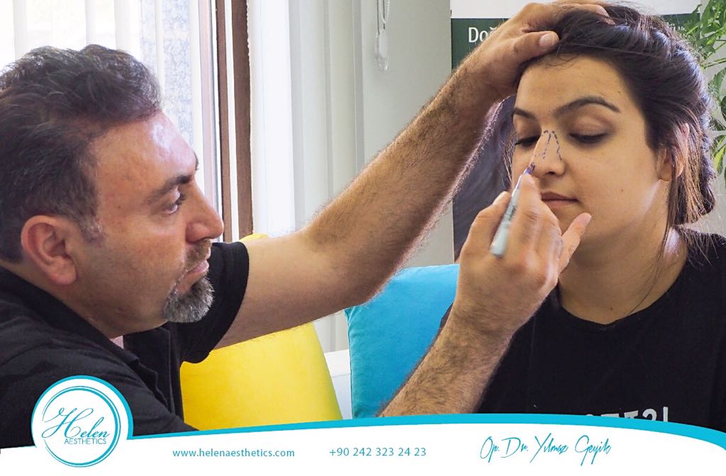 Burun yapınız yüzünüze uyumlu değilse veya nefes almanızı zorlaştırıyorsa, #BurunEstetiği - #Rinoplasti yaptırmayı değerlendirebilirsiniz.