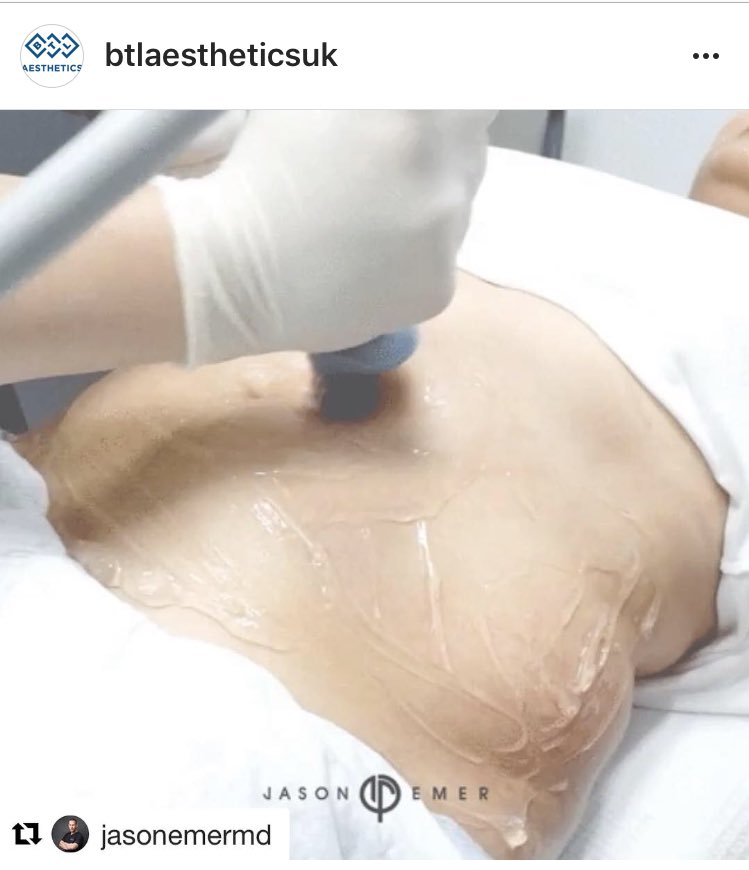 BTLAestheticsUK's tweet photo. Shown here courtesy of @JasonEmerMD, the BTL X-Wave acoustic shockwave device for body shaping & cellulite reduction #btlxwave https://t.co/YdWHdBZ1Ff