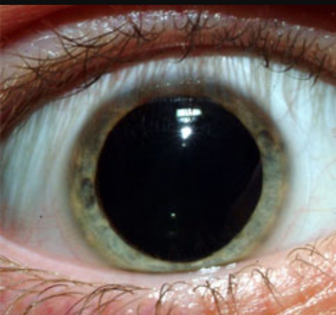 diabloscosito's tweet image. Dicen que se te dilatan las pupilas cuando hay algo que te gusta 
-