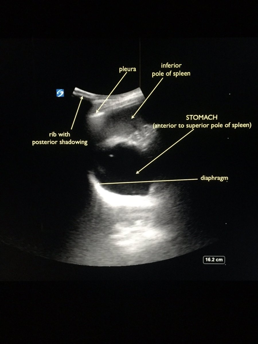 Meghan Herbst (@EUSmkh) | Twitter