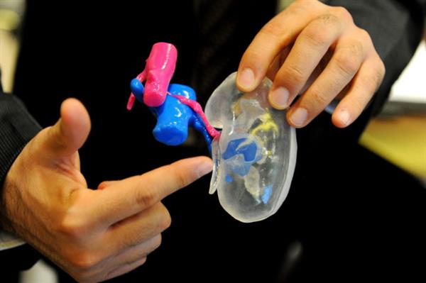 AdditiveCare's tweet photo. 3D prints help doctors communicate difficult ideas w/ incredible specificity:

"here's a normal kidney, here's your kidney, here's my plan" https://t.co/J9nXpMUOnw