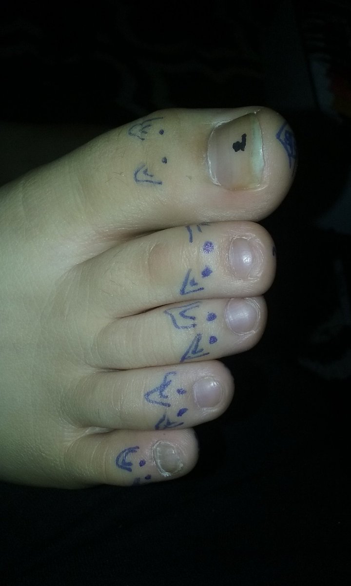 sara_tribula's tweet photo. This little piggy....... https://t.co/nPBz39ZKSI