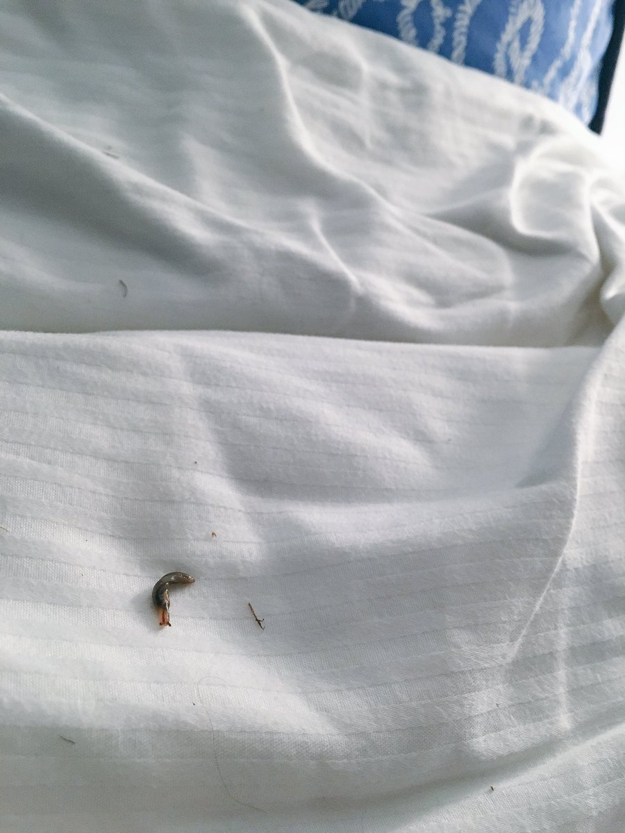 rnnbrnn's tweet photo. You wouldnt BELIEVE wat some sleeezy werm-boys do to get in bed with a lady!!! #transfigurationtuesday https://t.co/XAbFVQSnEH
