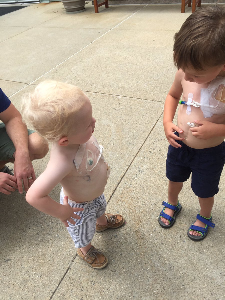gutsngumption's tweet photo. Brayden: You know, chicks dig scars💪  Camden: Yeah dude, we're set 💪
#warriors #intestinalmalrotation #volvulus #shortbowelsyndrome https://t.co/rpKQtdq0yL