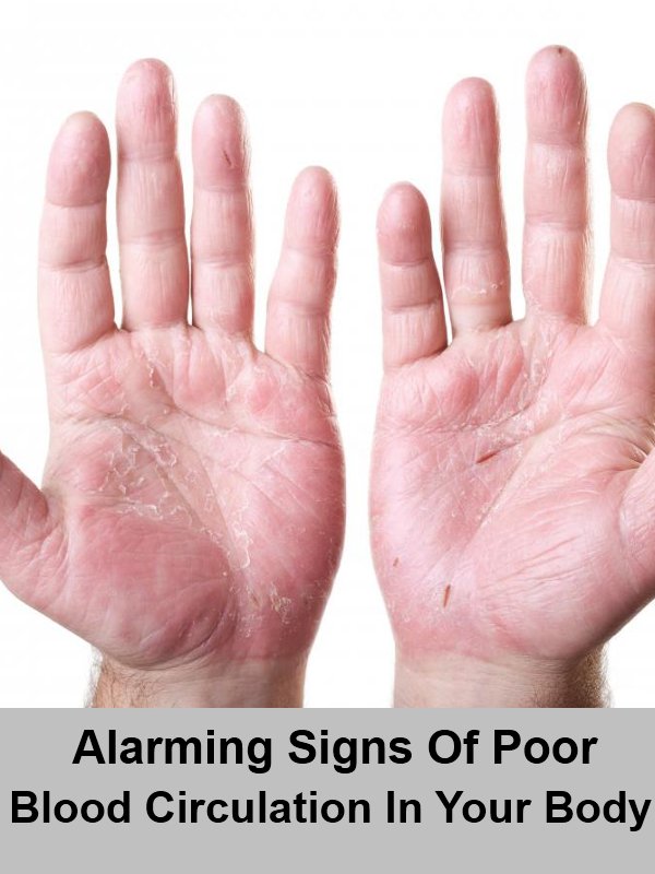 homeremedieshub's tweet image. 5 Alarming Signs Of Poor Blood Circulation In Your Body!
natural-homeremedies.org/5-alarming-sig…
#naturalhomeremedies #PoorBloodCirculation