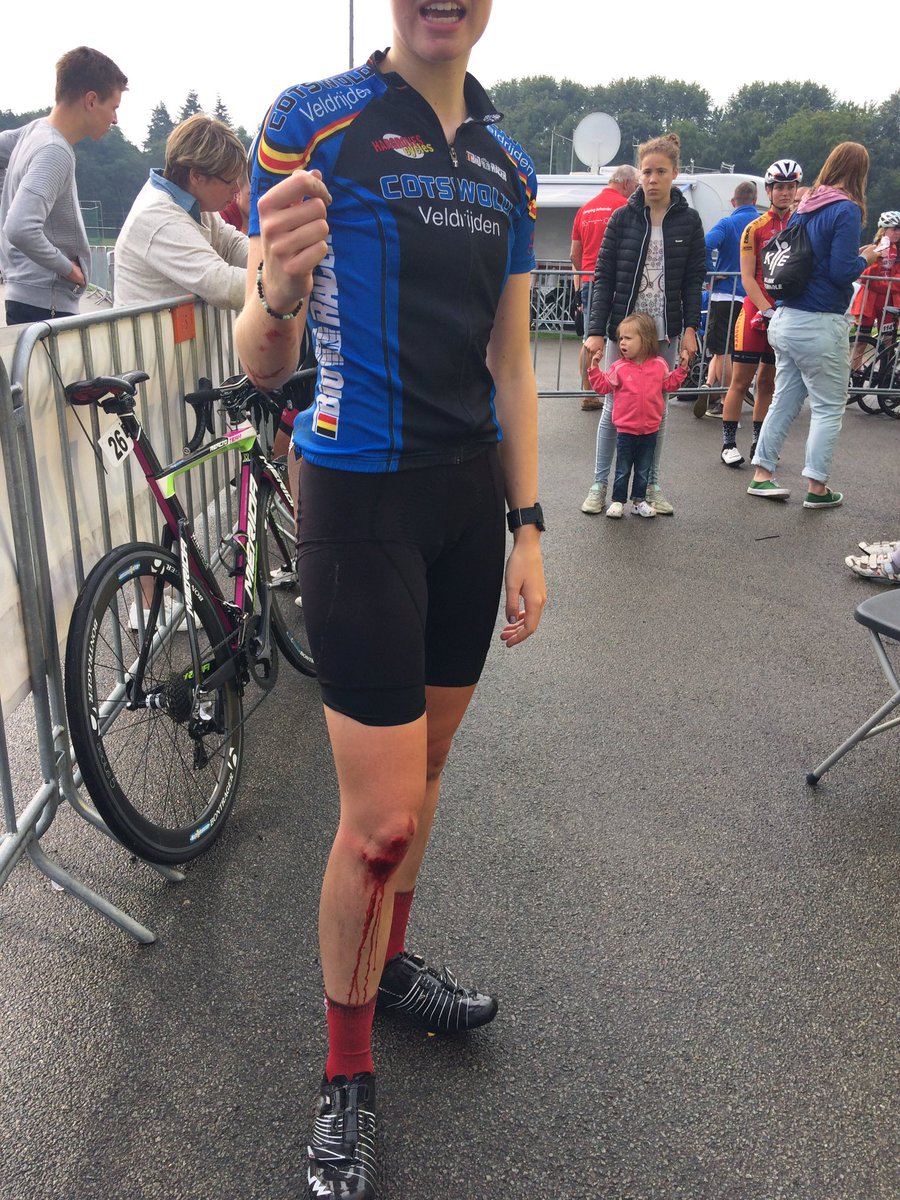 Willtrianddoit's tweet photo. Ouchy... @kjscott01 @CotswoldVeldrij @JeugdtourAssen #funracing https://t.co/ymjoGTpQ1U