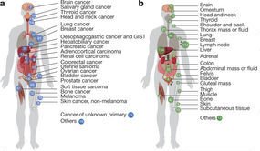 NatureGenet's tweet photo. Online @nature Integrative clinical genomics of metastatic cancer https://t.co/yU8QDulsoV https://t.co/ZXdmJsUryC