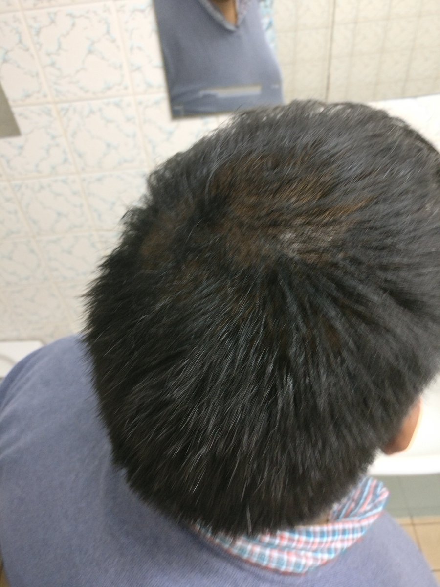 Hair Fibers tweet media