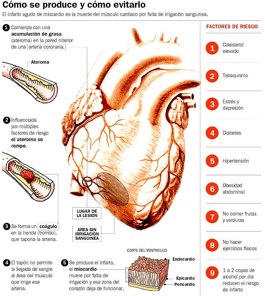 FFerrariOk's tweet photo. En 10 años⬆️18% las muertes por infartos pasaron de 14.502 a 17.130.y apuntan a que la gente consulta tarde y No recibe Dx. a tiempo 💕 https://t.co/rSJUHD6XWg