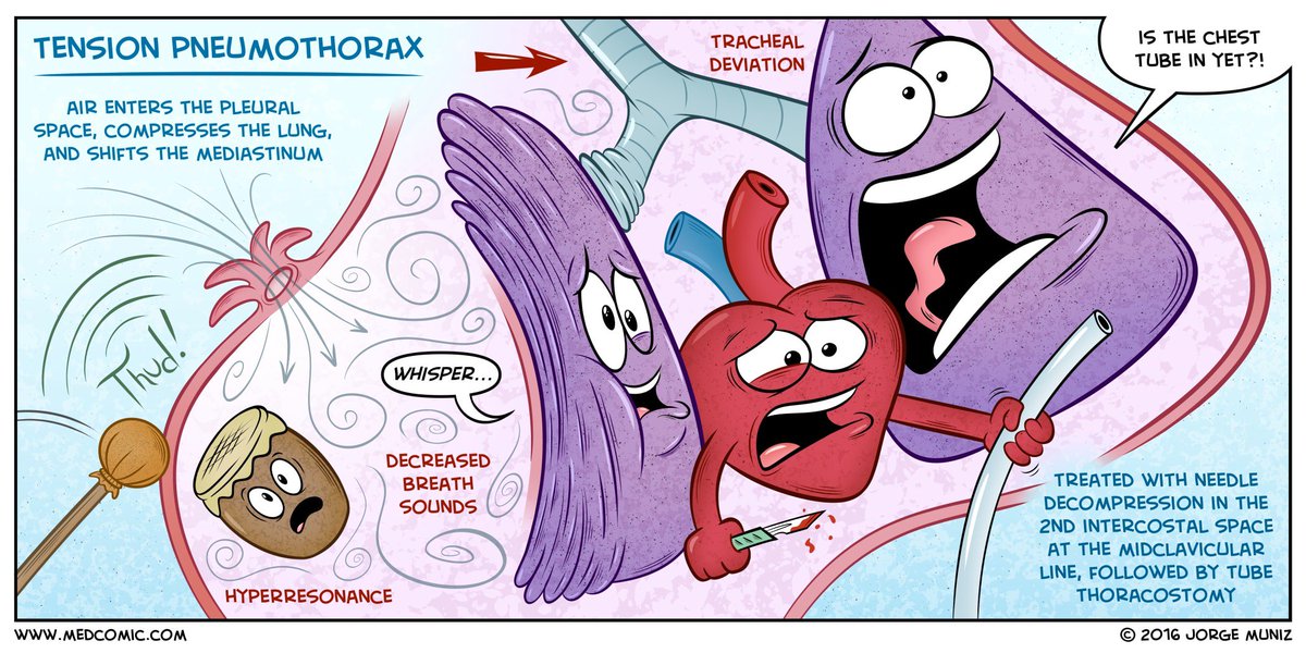 Clinical_Queen's tweet photo. #Nurse #Nursing #NursingStudent #MedComic #Clinical_Queen https://t.co/jmqShFgDuY