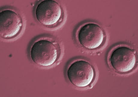 #genetica #medicina Corretta con CRISPR una mutazione in embrioni umani tinyurl.com/yca2kax9