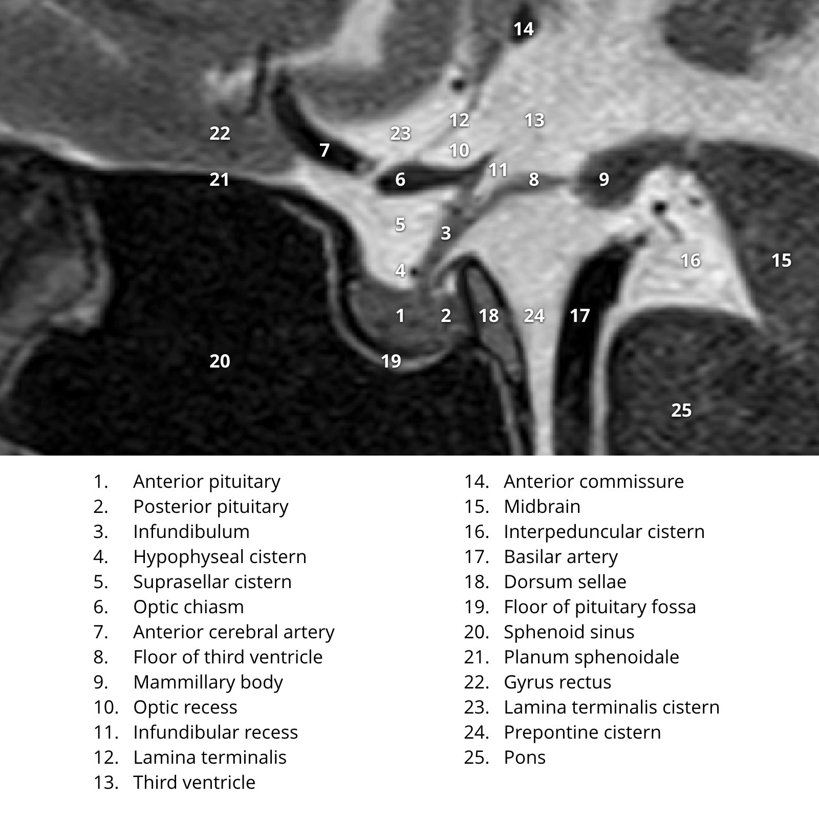 Pituitary Gland Anatomy Biology Diagrams