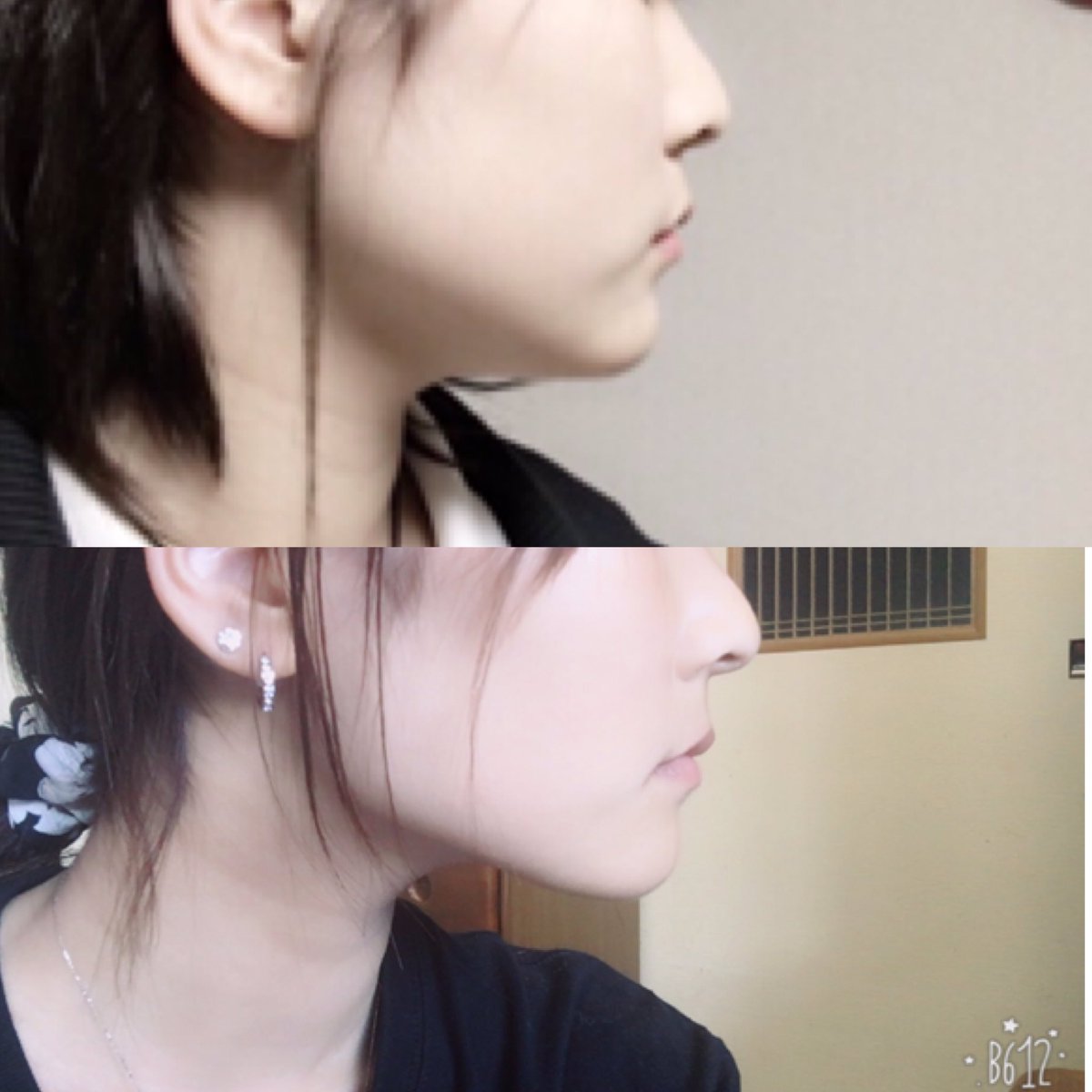mk_mk_00's tweet photo. 165cm ❁ 58㌔→48㌔

痩せてよかった！！🐷
頑張ってよかった！！🐷
今日も頑張るよ！！！🐷

約3ヶ月🖤🖤🖤 https://t.co/5d9kKnAseY