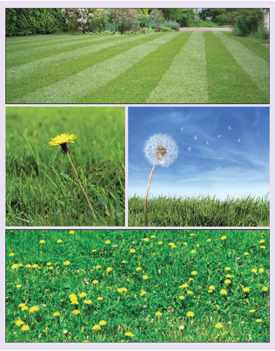 LambAlastair's tweet photo. PSMA-PET & Dandelions-The Phytological Future of #ProstateCancer staging! @fsgfon https://t.co/GzrUn37oBi
Full text: https://t.co/LAB0ZLWchJ https://t.co/hbI1sW4mpj