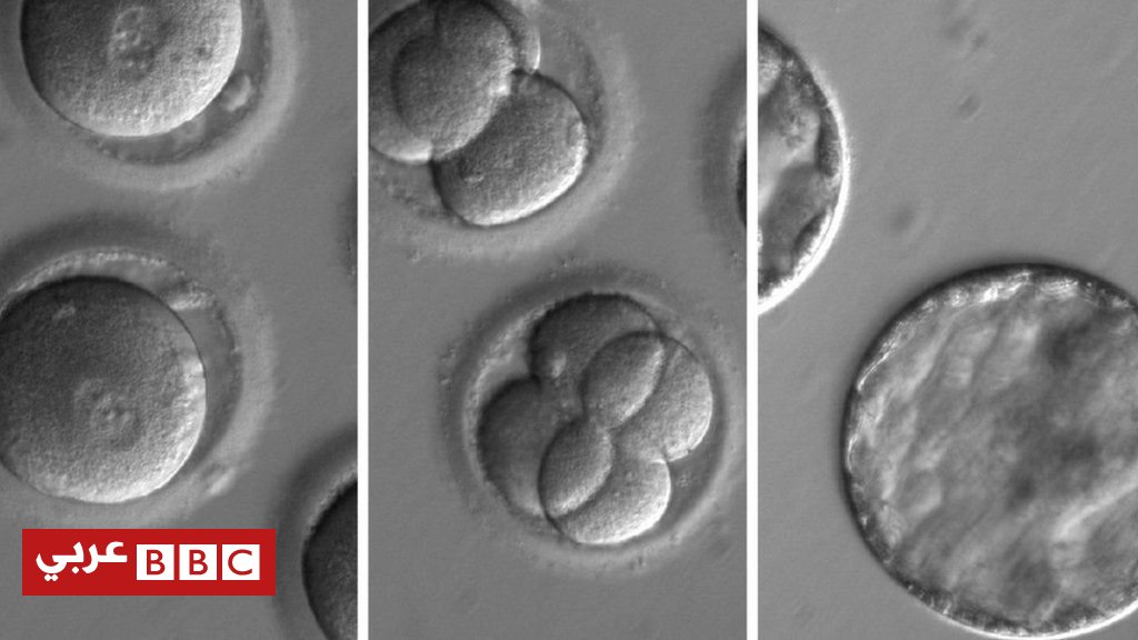 BBCArabic's tweet image. نجاح علماء في ازالة جزء من جين يسبب توريث مرض قلبي خطير bbc.in/2uZyucF