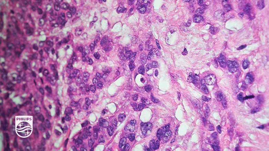 Philips Healthcare tweet media