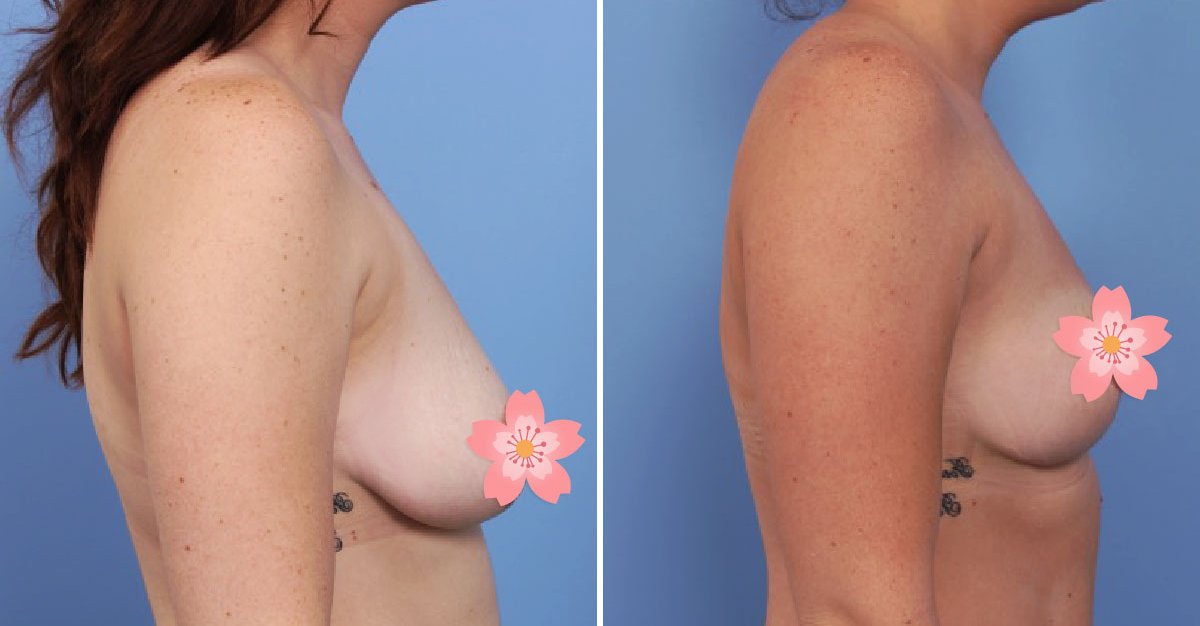 Enhanceps's tweet image. At Enhance we are not simply focused on surgery, we are focused on changing lives, on changing YOUR life. 
#boostedbydrbroady
#drbroady