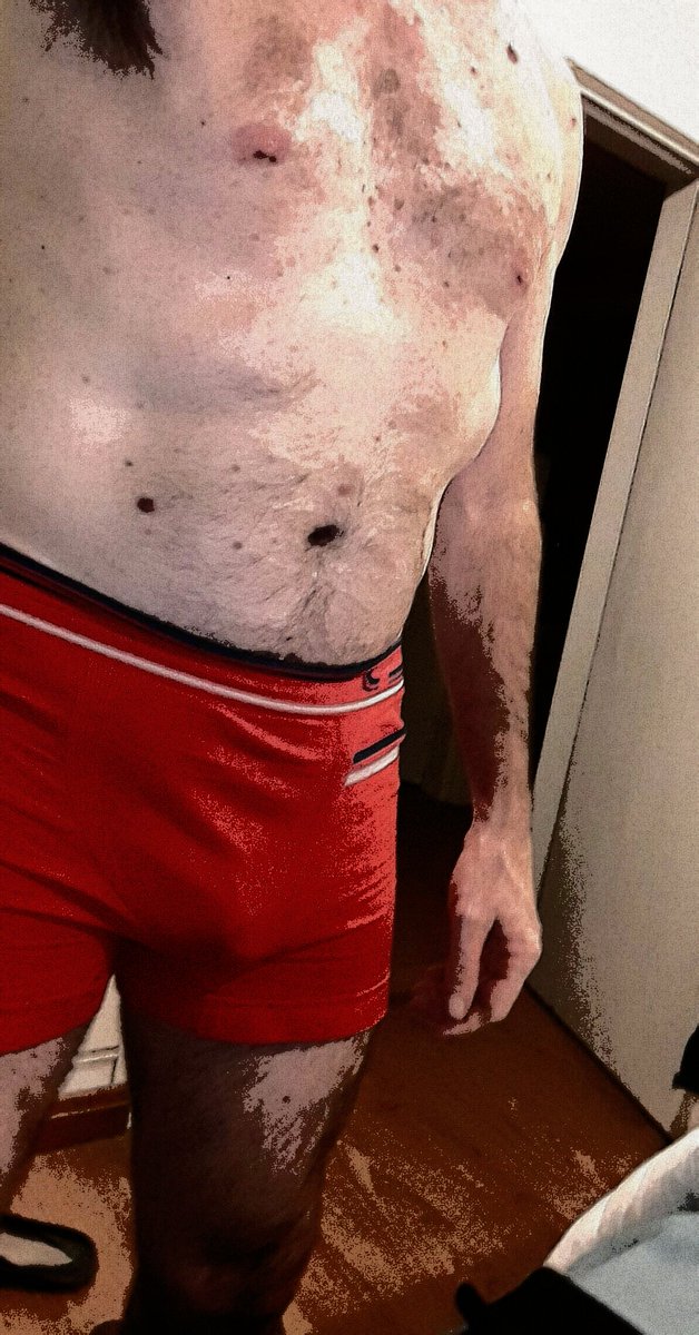 JULIANplus's tweet photo. #buenastardes / #BuenasNoches #camily β€οΈ #cam4mod
π #mustwatch https://t.co/J5PqQAB1VX
π #mustfollow @schoolmary1 https://t.co/LGs45EuIli