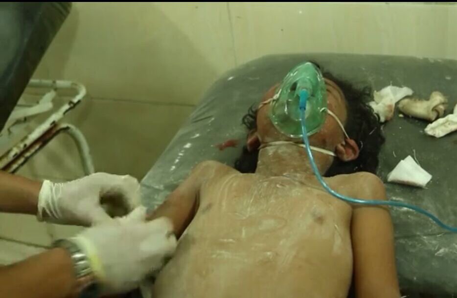 Ey dünya, ey insanlık, ey Müslümanlar Rakka'da haftalardır IŞİD bahanesiyle minicik çocuklar katlediliyor.
Haberin var mı?