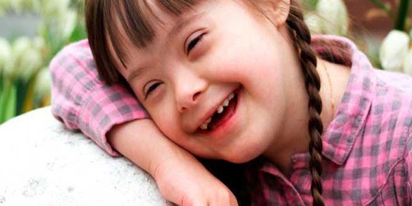 Lenguaje comprensivo y expresivo en síndrome de Down goo.gl/6ONtCv