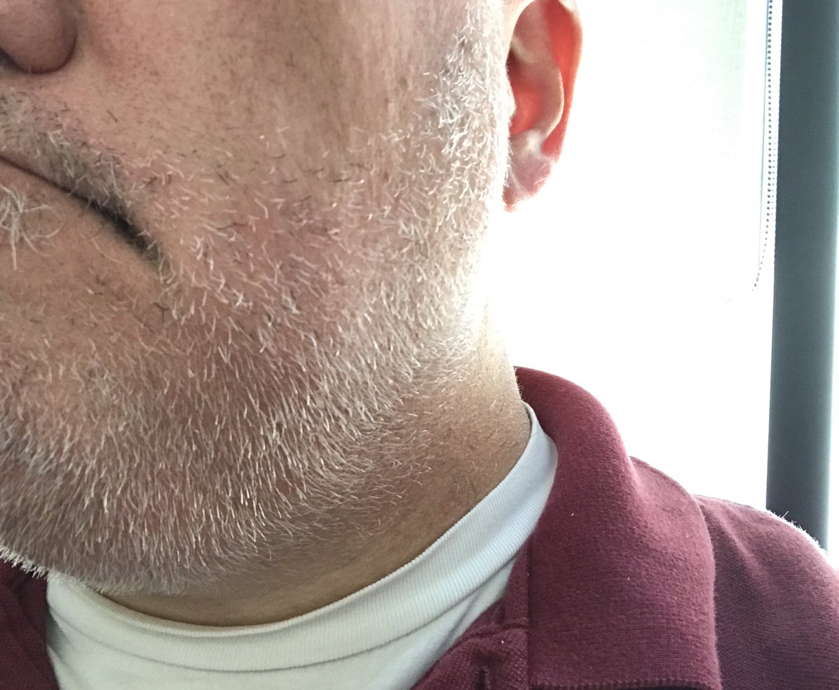 falfa's tweet photo. #BeachBeard coming along nicely. Still 3 weeks until we travel. https://t.co/Xatk0UrDSh