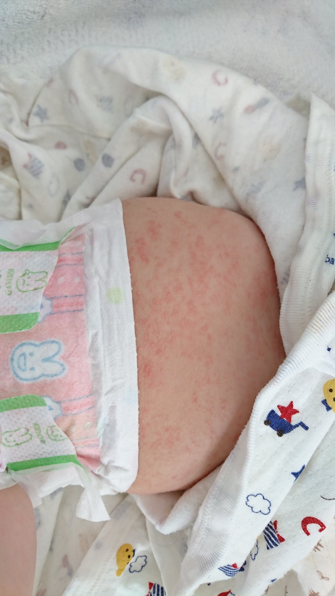 O Xrhsths しめじはナマケモノ Sto Twitter 母乳の方で赤ちゃんがある程度の月齢になっても 湿疹 が良くならない って人はお母さんを通してアレルゲンを体に取り込んでしまい アレルギー反応を起こしてしまっている場合があります うちはそれで検査をした結果